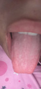 UC
